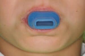 Аппарат Face Former фото 2