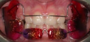 Регулятор функции Френкеля фото 2